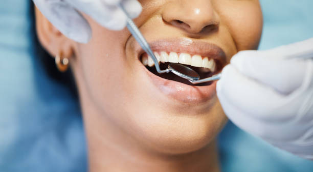 Best Emergency Wisdom Tooth Extraction in Port Jefferson Station, NY